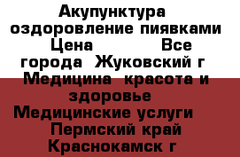 Акупунктура, оздоровление пиявками › Цена ­ 3 000 - Все города, Жуковский г. Медицина, красота и здоровье » Медицинские услуги   . Пермский край,Краснокамск г.